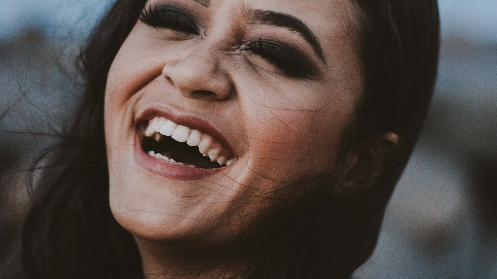 Invisalign and whitening